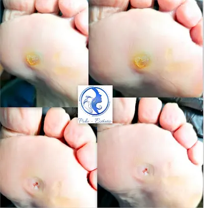 Podo-Esthetic Podolog, Kosmetolog, Makijaż permanentny Anna Nepelska-Żak Kędzierzyn-Koźle